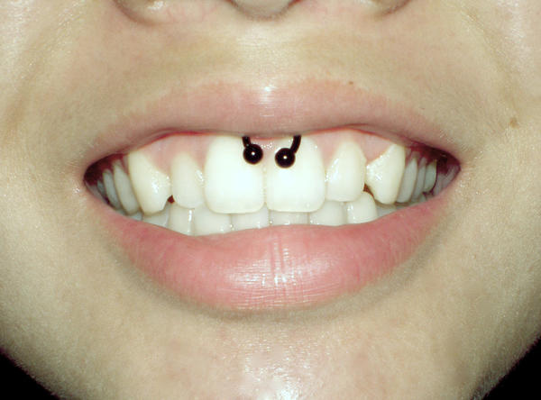 small smiley piercing. small smiley piercing.