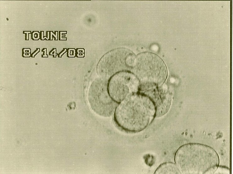 ivf embryo
